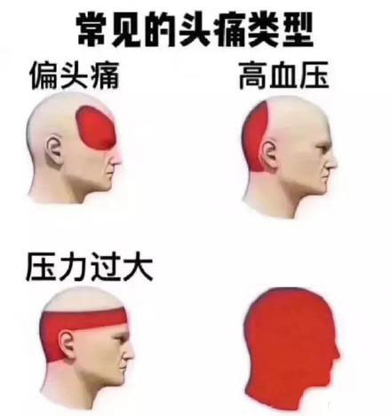 打工人、设计师看过来！这套「头疼类型」表情包火了