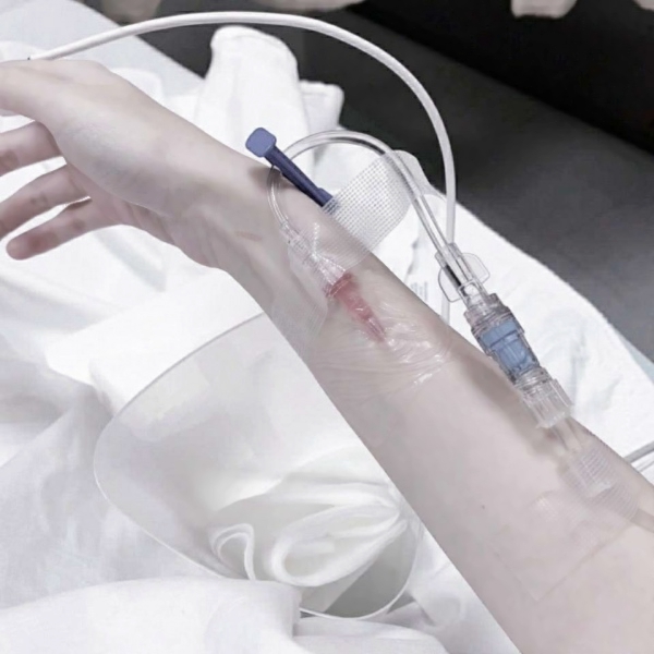 女生输液好看手背头像合集 9张超清病房吊针手部素材